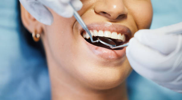 Best Pediatric Emergency Dentist in Southchase, FL